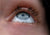 Why your eyelash is falling out?